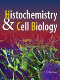 The histomorphological and stereological assessment of rat dorsal root ganglion tissues after various types of sciatic nerve injury