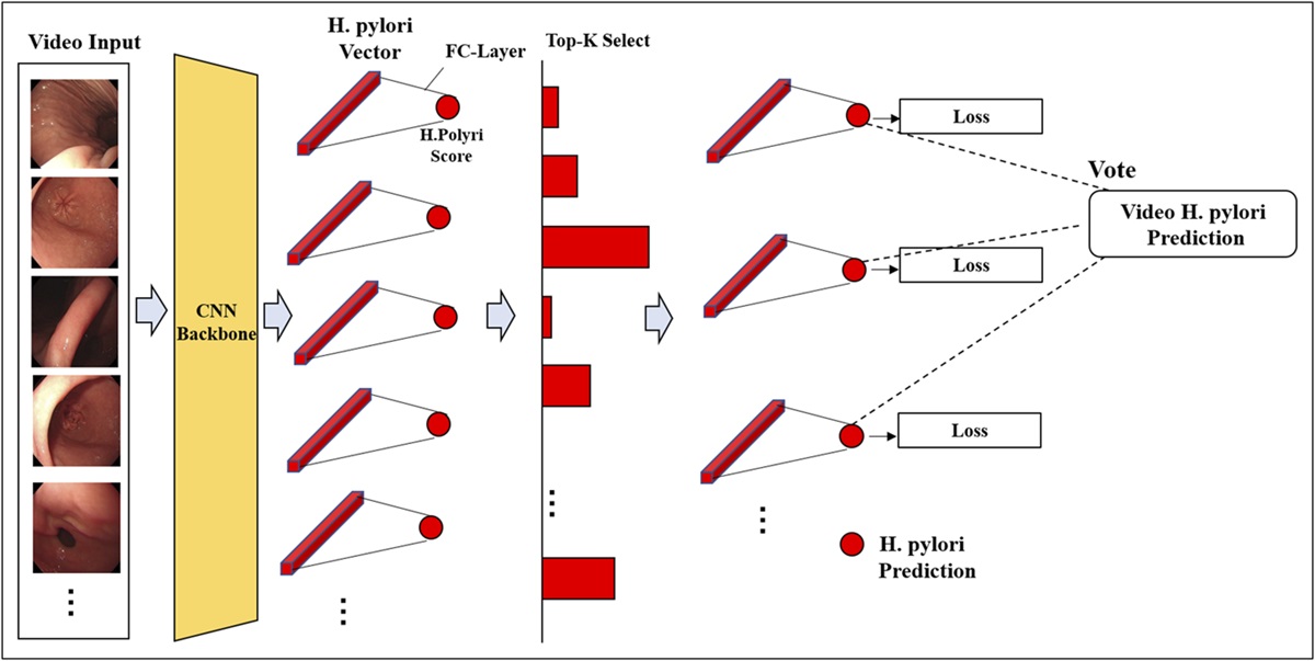 Real-Time Evaluation of Helicobacter pylori Infection by Convolution Neural Network During White-Light Endoscopy: A Prospective, Multicenter Study (With Video)