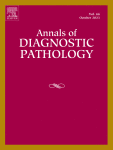 Utility of MUC4 in the diagnosis of secretory carcinoma of salivary glands