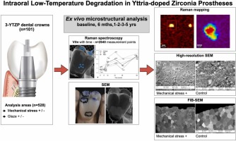 Intraoral low-temperature degradation of monolithic zirconia dental prostheses: 5-year results of a prospective clinical study with ex vivo monitoring