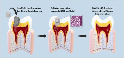 Three-dimensional eco-friendly bacterial nanocellulose (BNC) scaffold for regenerative dentistry: Characterization, cytocompatibility and differentiation potential