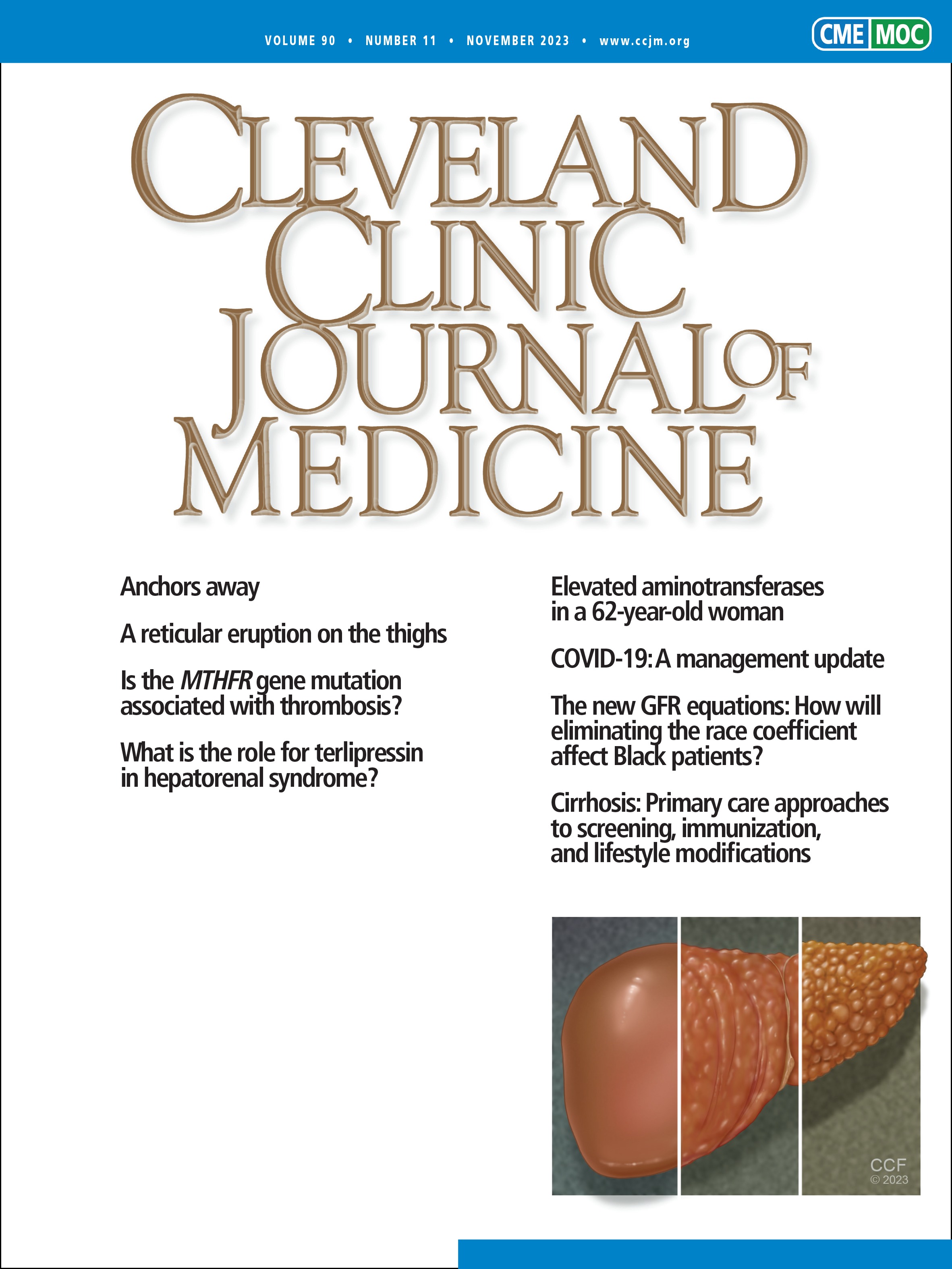 The new GFR equations: How will eliminating the race coefficient affect Black patients?