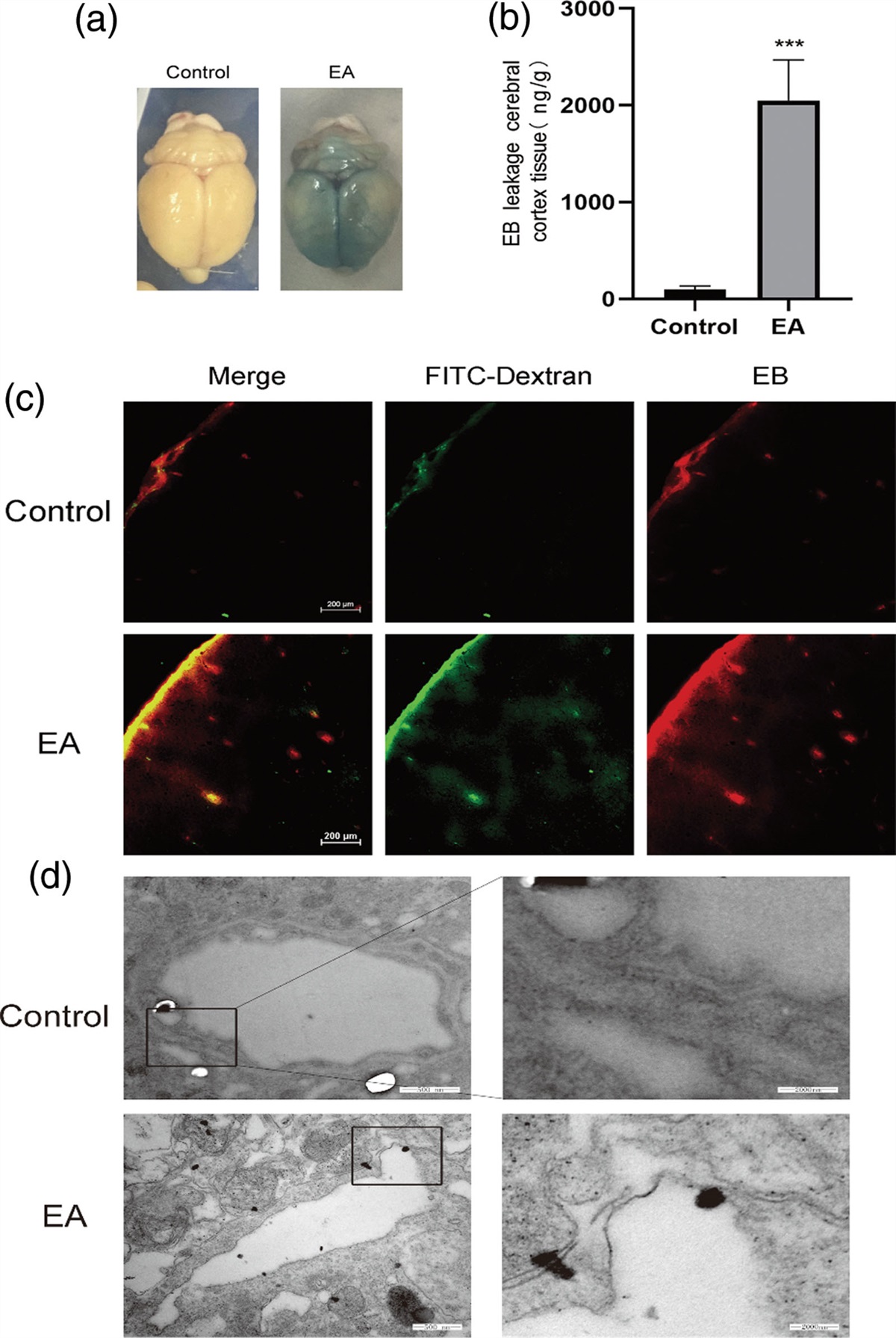 Acupuncture with specific mode electro-stimulation effectively and transiently opens the BBB through Shh signaling pathway