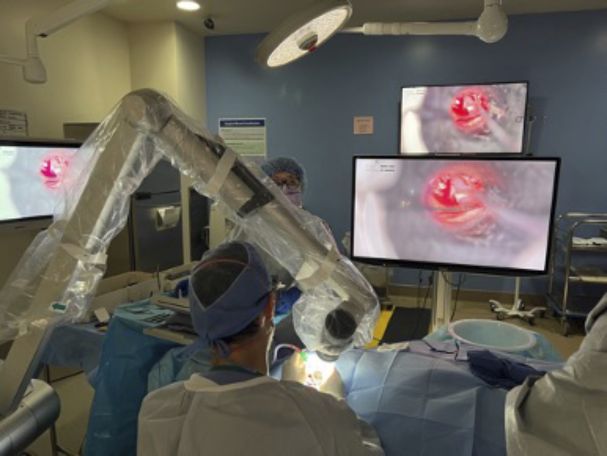 Exoscope-Assisted Stapedotomy: Evaluation of Safety and Efficacy