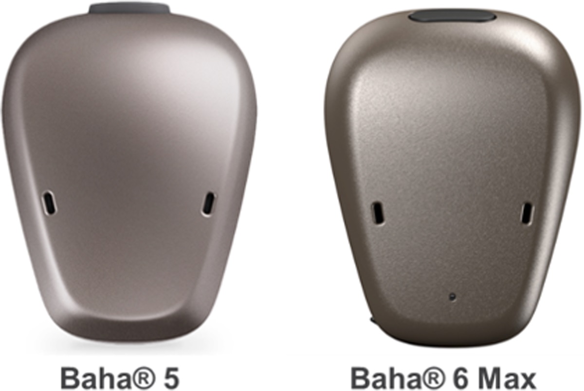 High-Frequency Gain and Maximum Output Effects on Speech Recognition in Bone-Conduction Hearing Devices: Blinded Study
