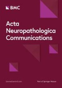 Tau seed amplification assay reveals relationship between seeding and pathological forms of tau in Alzheimer’s disease brain