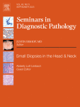 CHALLENGES AND PITFALLS IN THE DIAGNOSIS OF IgG4-RELATED DISEASE