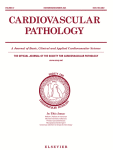 Characteristics of Lambl Excrescences of Aortic and Pulmonary Valvesin Healthy Hearts: Lambl Excrescences