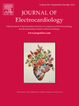 Acute coronary syndrome with single‑lead ST segment elevation: A rare presentation of multivessel coronary artery disease