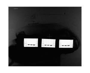 Macrophages-derived exo-miR-4449 induced by Cryptococcus affects HUVEC permeability and promotes pyroptosis in BEAS-2B via the HIC1 pathway