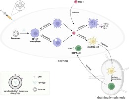 Targeted delivery of herpes simplex virus glycoprotein D to CD169+ macrophages using ganglioside liposomes alleviates herpes simplex keratitis in mice