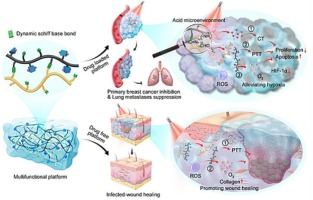 Multifunctional hydrogel for synergistic reoxygenation and chemo/photothermal therapy in metastatic breast cancer recurrence and wound infection