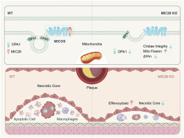 Macrophage-specific deletion of MIC26 (APOO) mitigates advanced atherosclerosis by increasing efferocytosis