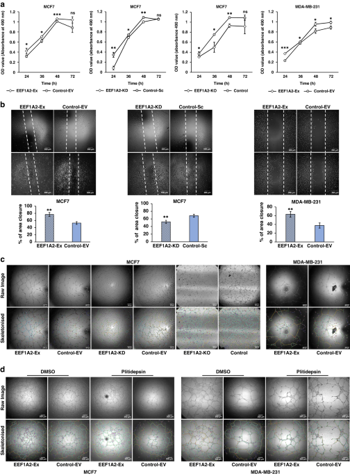 EEF1A2 promotes HIF1A mediated breast cancer angiogenesis in normoxia and participates in a positive feedback loop with HIF1A in hypoxia