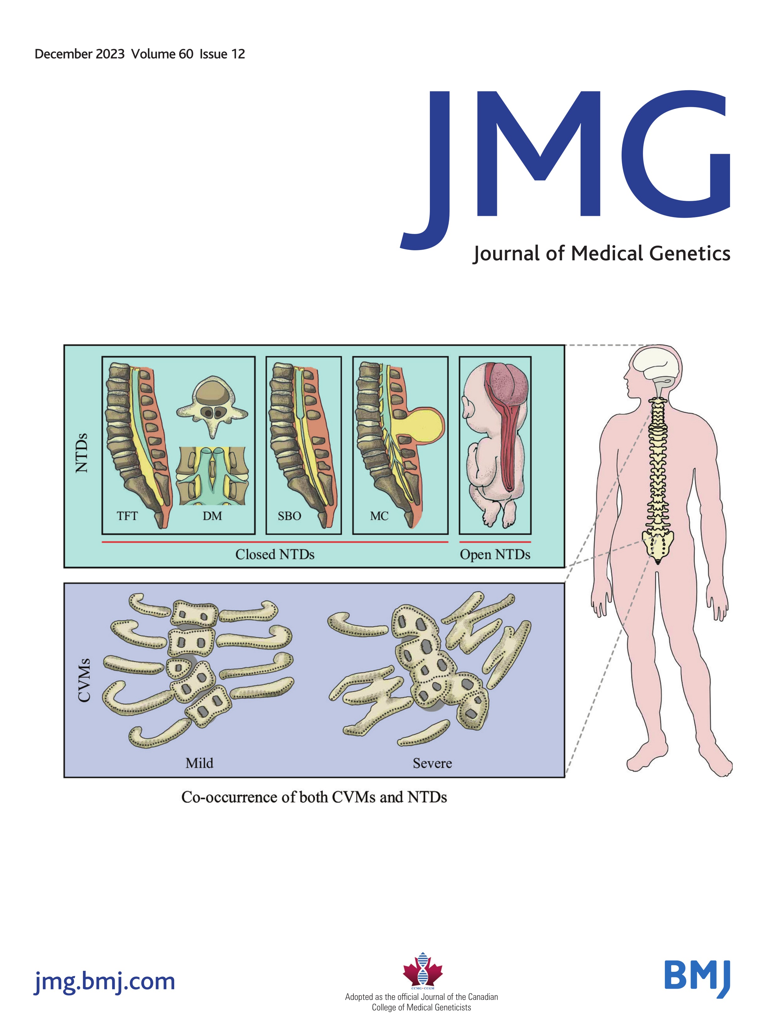 Deep phenotyping of the neuroimaging and skeletal features in KBG syndrome: a study of 53 patients and review of the literature