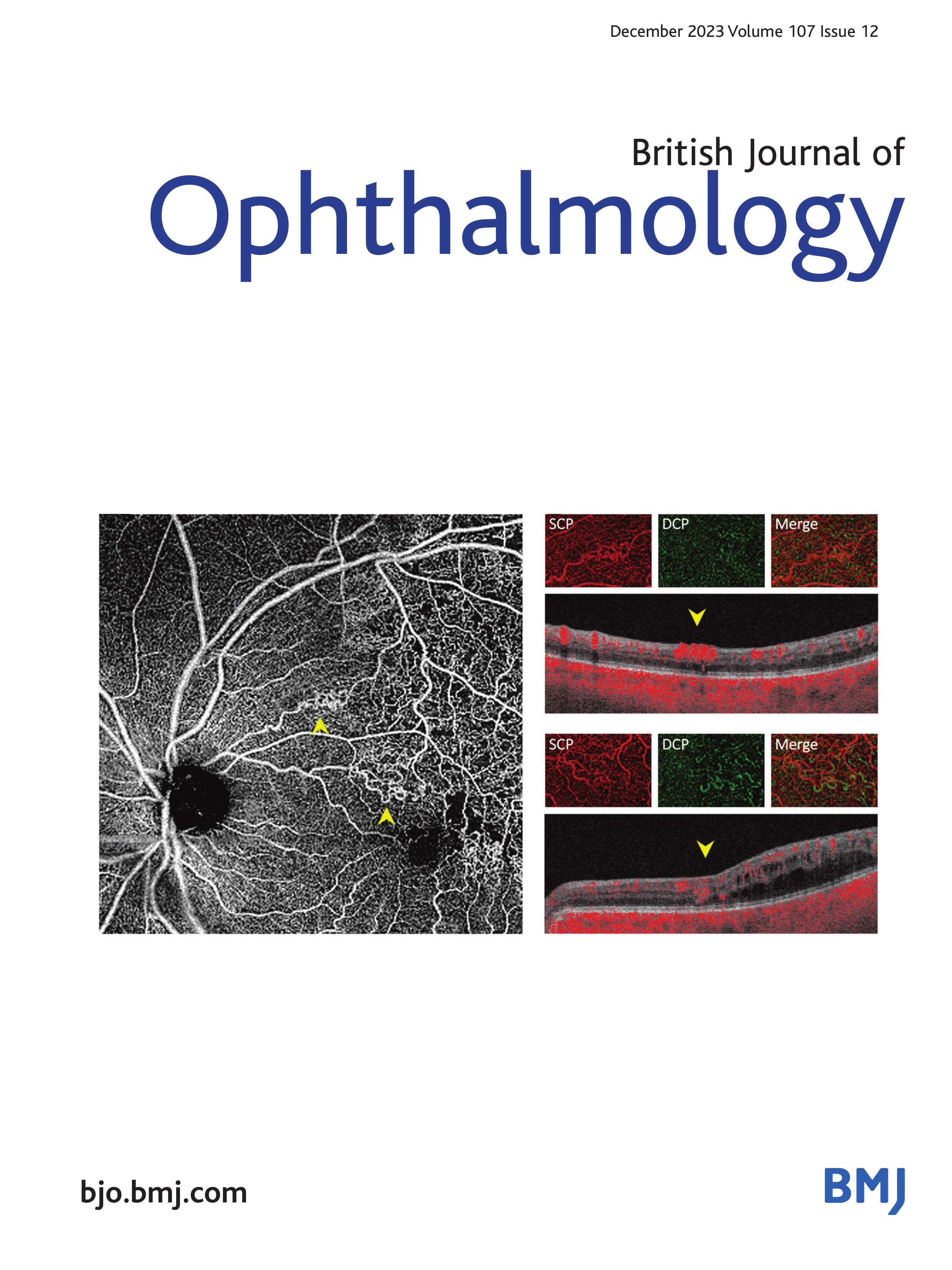 Risk factors associated with abandonment of care in retinoblastoma: analysis of 692 patients from 10 countries