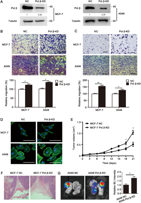 Correction: DNA polymerase beta modulates cancer progression via enhancing CDH13 expression by promoter demethylation