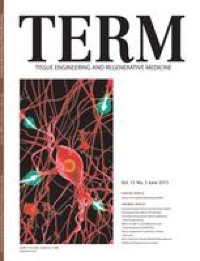 Strategies for Constructing Tissue-Engineered Fat for Soft Tissue Regeneration