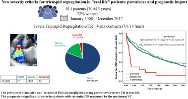 New severity criteria for tricuspid regurgitation in a broad population of “real life” patients: Prevalence and prognostic impact